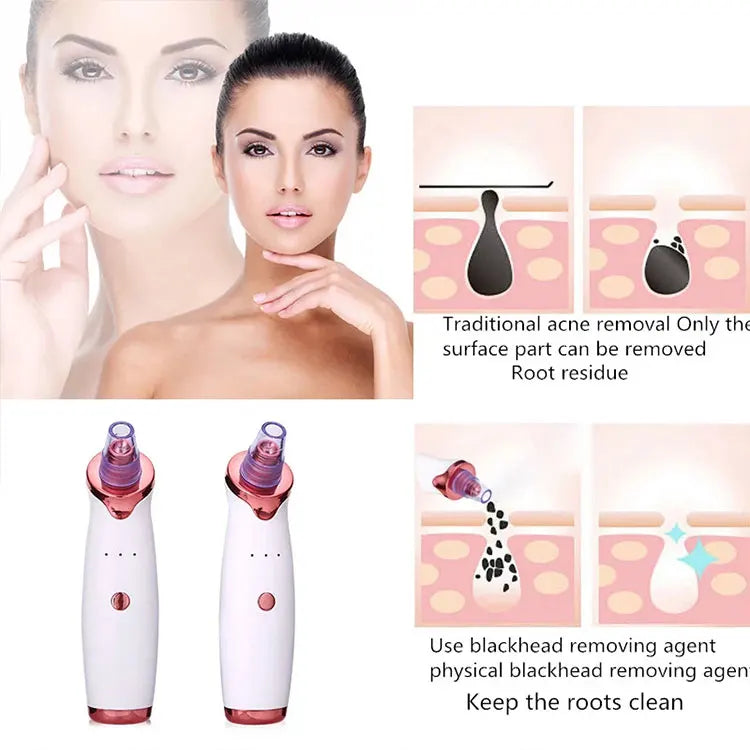 2021 Nose Facial Pore Cleaner Suction Blackhead Remover Machine Electric Acne Treatment US/AU Plug Compatible